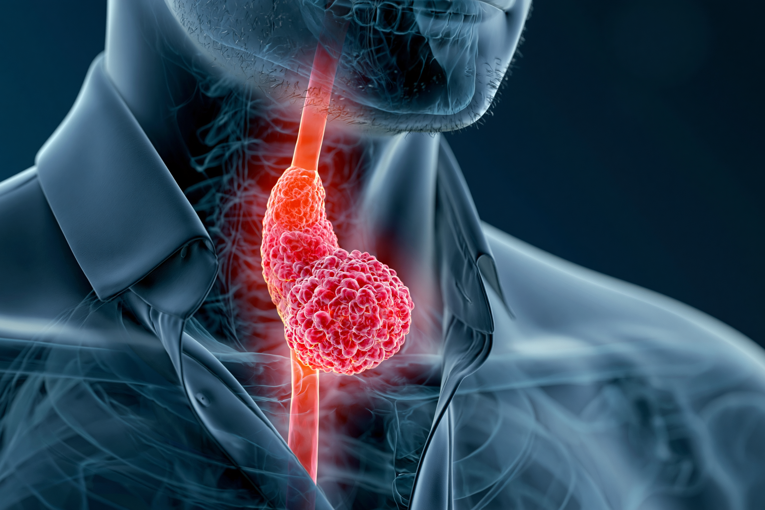 Esophagus &Amp; Gej Cancer Ayurvedic Treatment Support For Healing, Strength, And Remission-Focused Recovery 1 0 0 3 12 scaled