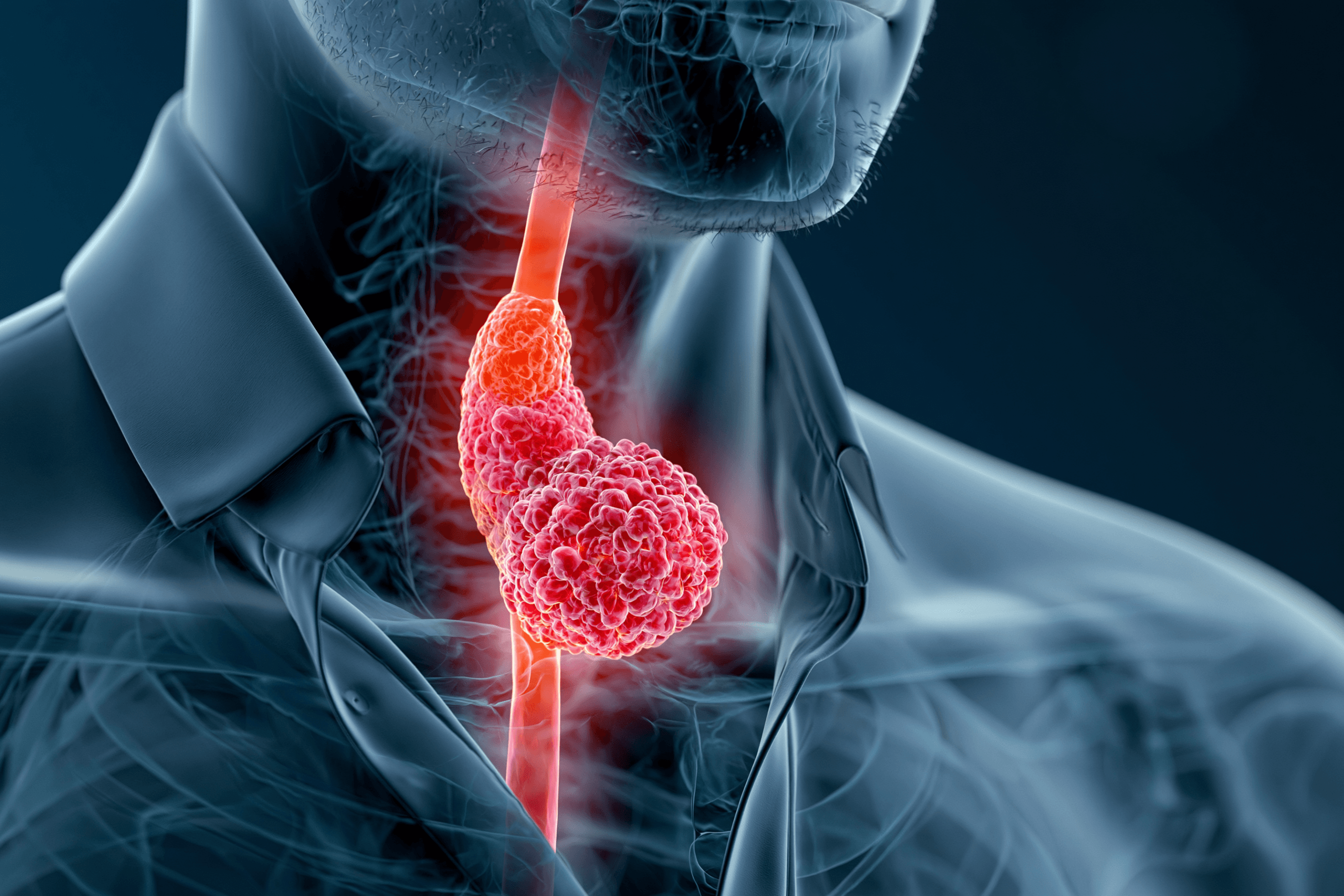 Esophagus &Amp; Gej Cancer Ayurvedic Treatment Support For Healing, Strength, And Remission-Focused Recovery 1 0 0 3 12 scaled