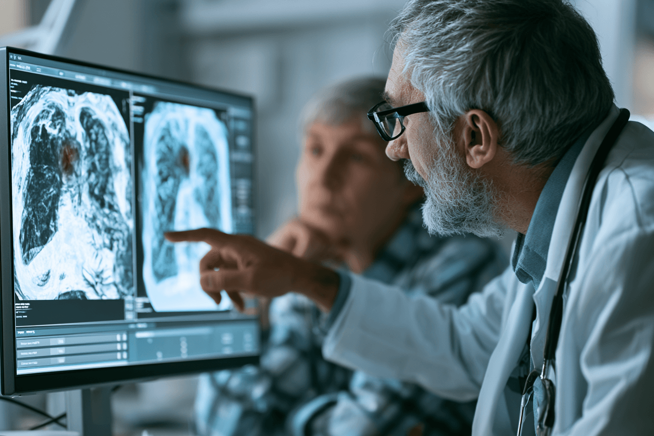 Small Cell Lung Cancer Treatment: Chemotherapy, Immunotherapy And Radiation 2 0 0 45
