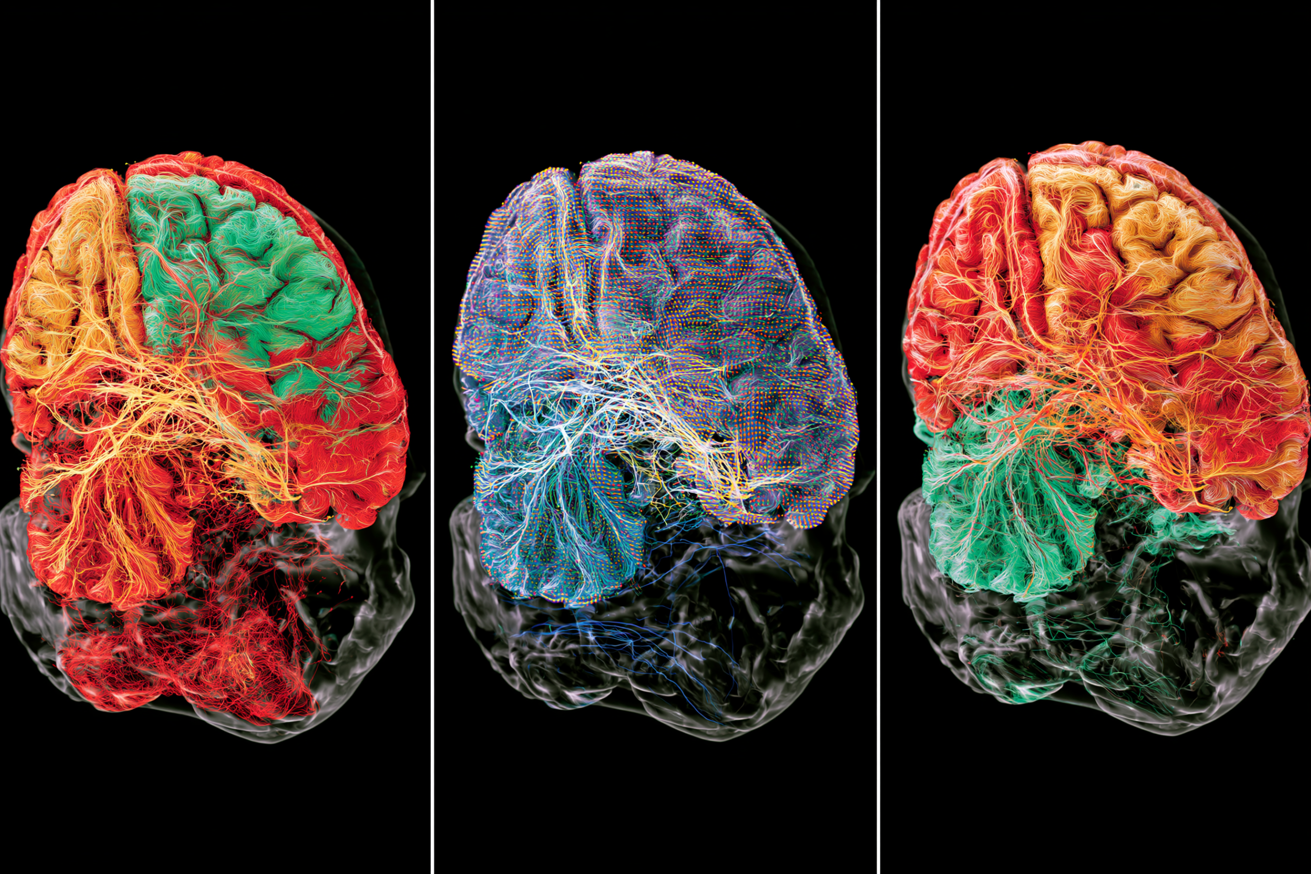 Glioma Vs Glioblastoma: Differences In Grade, Growth, Treatment, And Survival 6 0 2 3 6 scaled