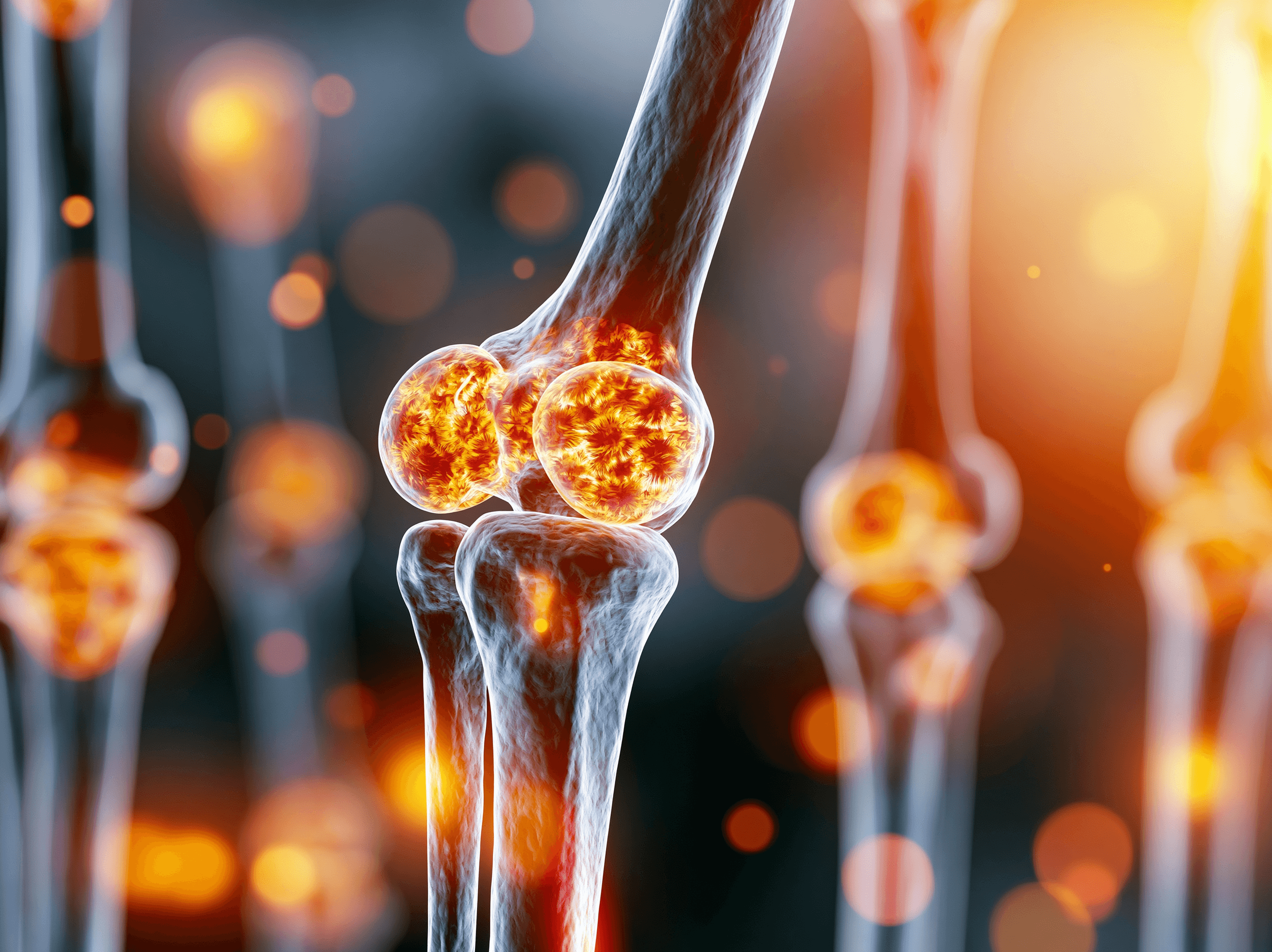 High Pth But Normal Calcium: What It Really Means 12 0 3 1 7