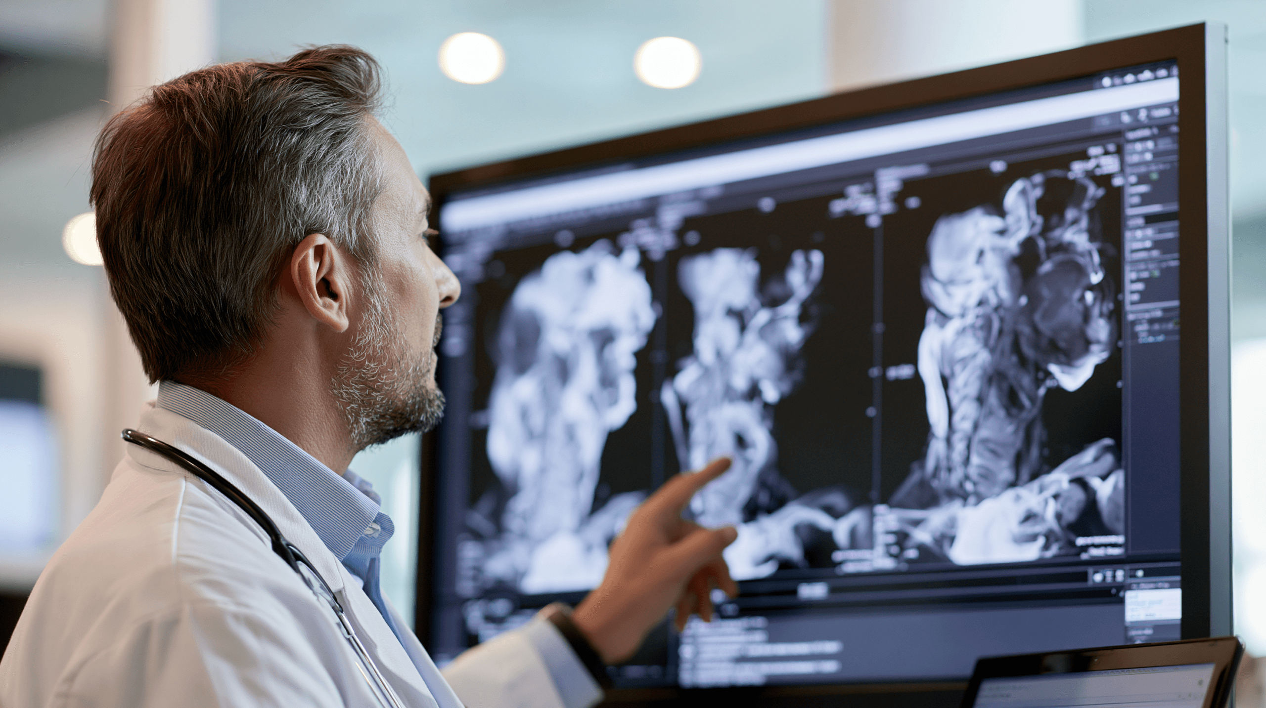 Anaplastic Thyroid Cancer Survival Rate: Life Expectancy By Stage, Treatment And Individual Prognosis 6 0 3 2 28 scaled