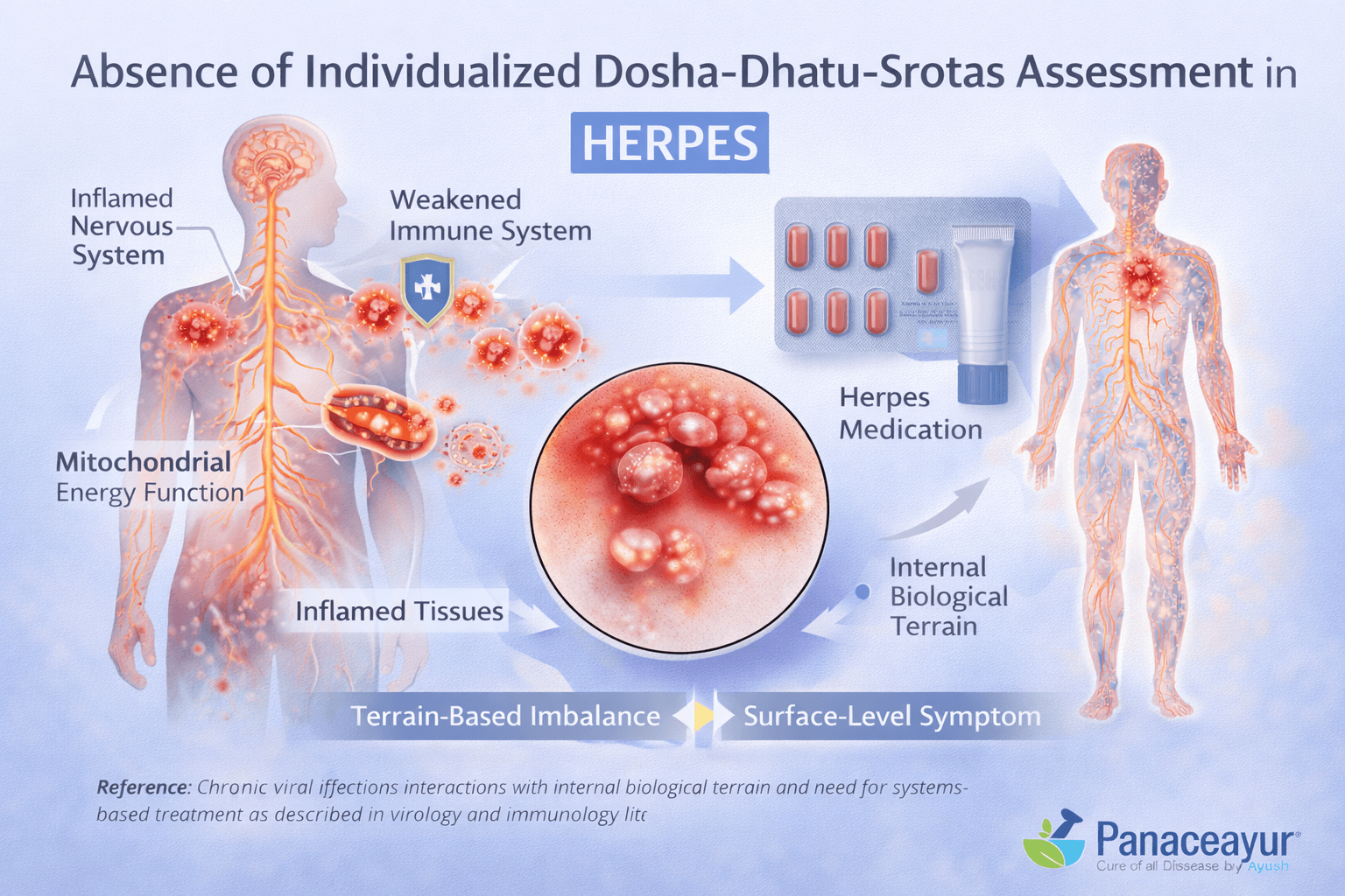 Why Herpes Medicines Fail-The Real Reason Outbreaks Keep Coming Back 3 Absence of individualized dosha dhatu srotas assessment