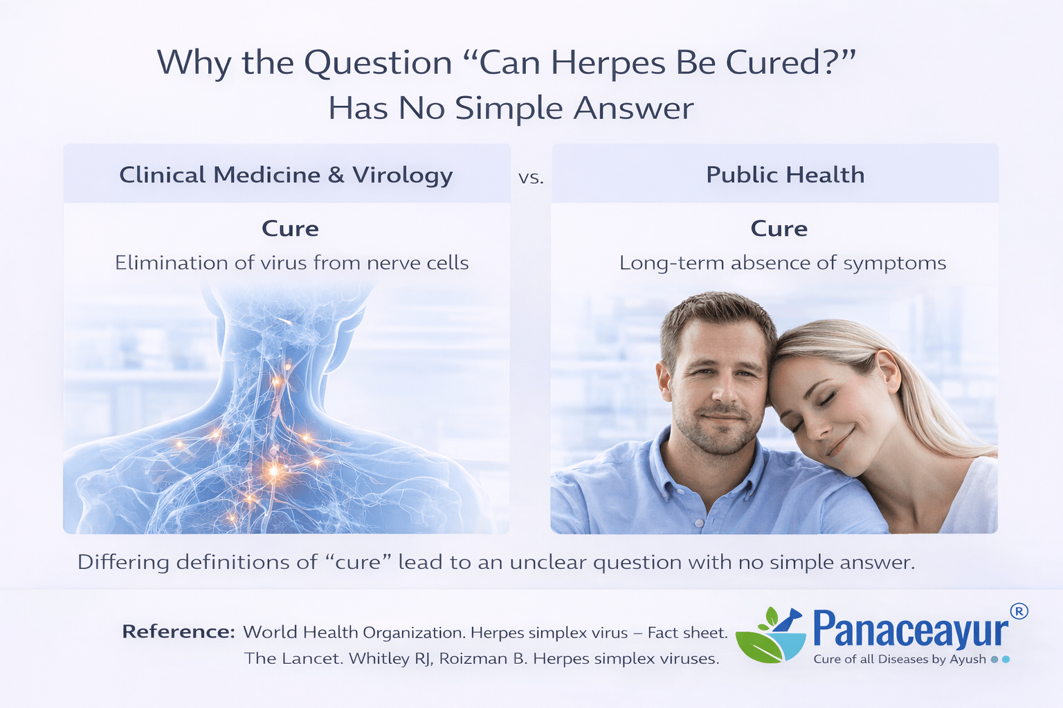 Can herpes be cured permanently