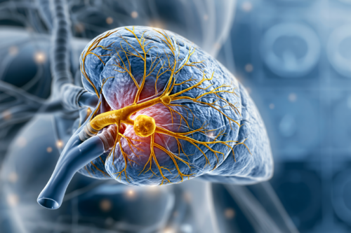 Cholangiocarcinoma cancer illustration showing liver, bile ducts, bile duct obstruction, and tumor location