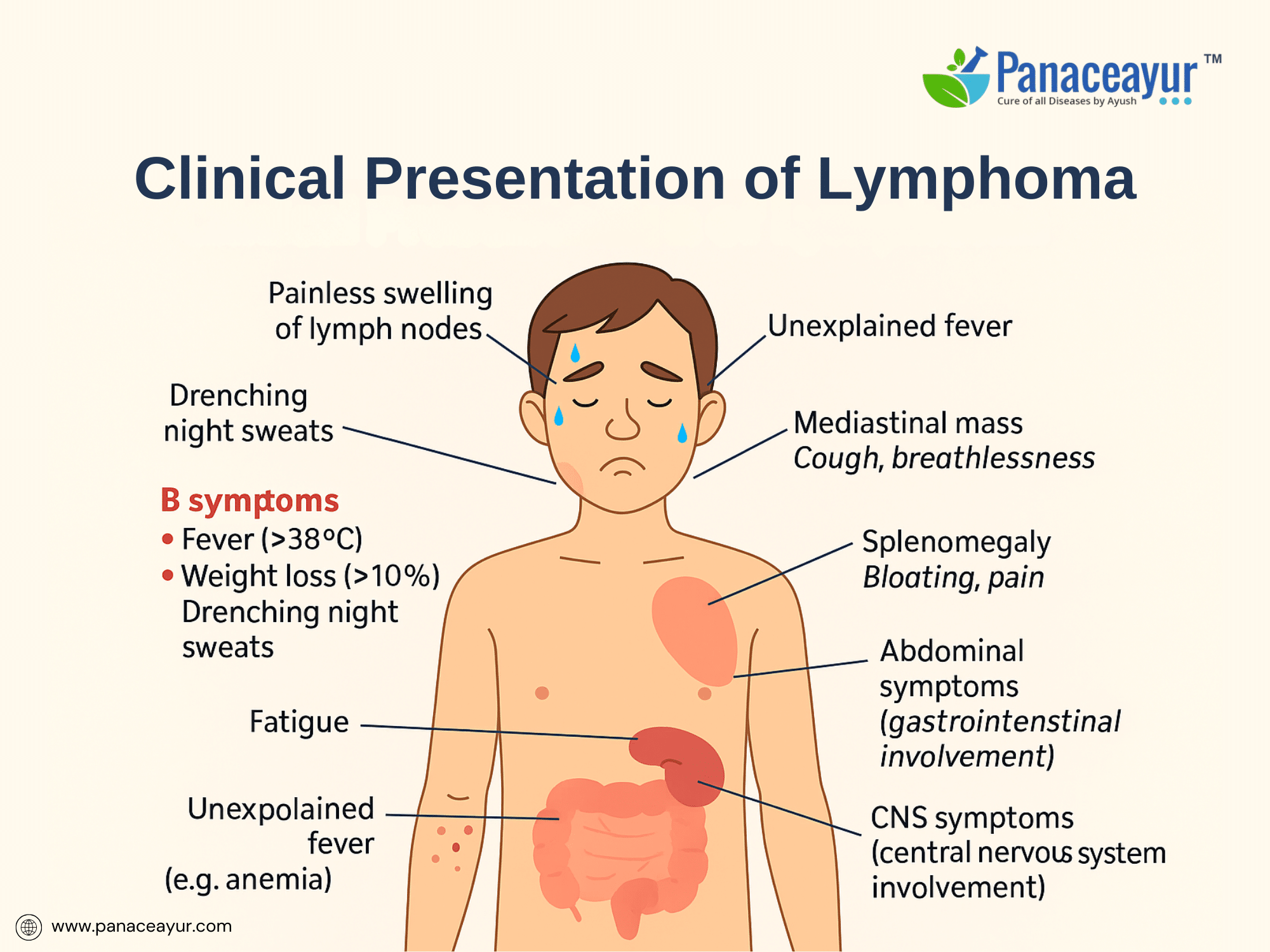 Clinical presentation of lymphoma