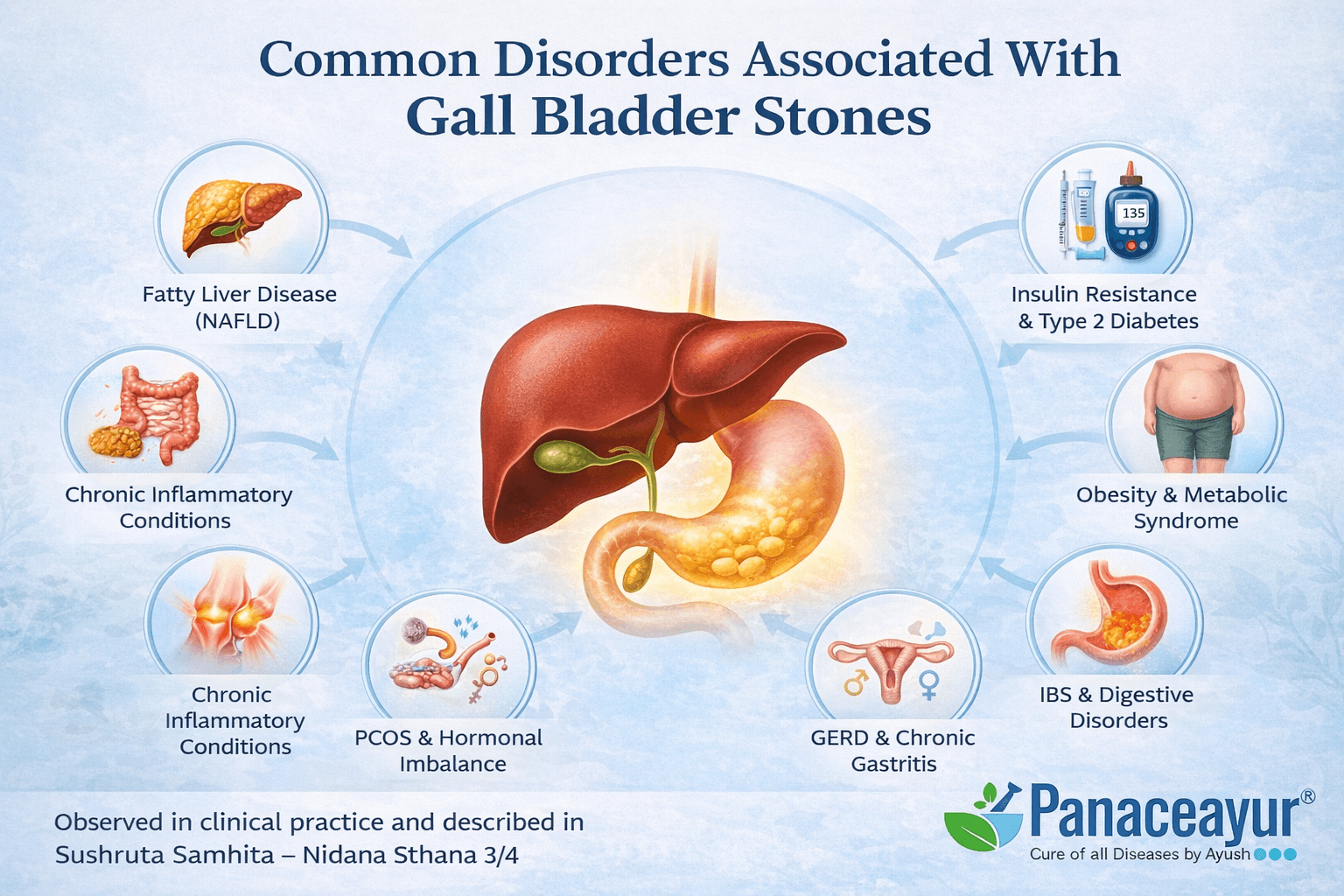 Educational medical image illustrating common disorders associated with gall bladder stones, including fatty liver, diabetes, obesity, ibs, thyroid imbalance, and hormonal disorders, with integrated ayurvedic and modern medical perspective and panaceayur logo in the footer.
