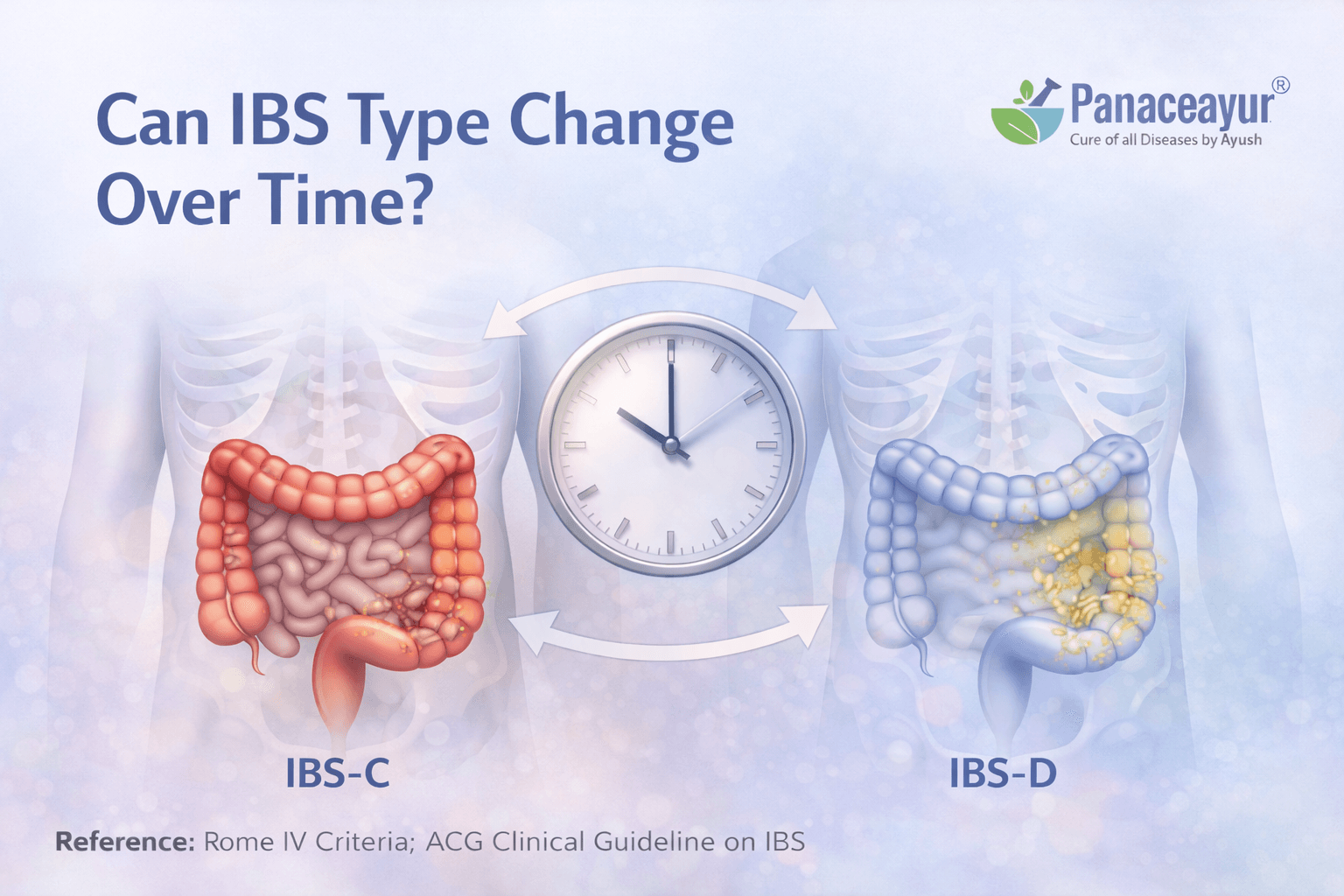Can Ibs Type Change Over Time Explained Medical illustration explaining how ibs types can change over time, showing shifts between constipation predominant, diarrhea predominant, and mixed irritable bowel syndrome patterns.