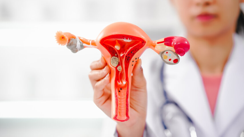 Doctor holding uterus and fallopian tube anatomical model during fertility consultation to explain female infertility causes.