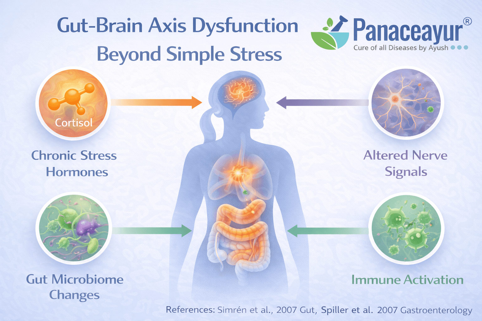 Gut–Brain Axis Dysfunction Beyond Simple Stress Medical infographic illustrating gut–brain axis dysfunction in irritable bowel syndrome, showing how stress hormones, altered nerve signaling, immune activation, and microbiome changes interact beyond simple stress.
