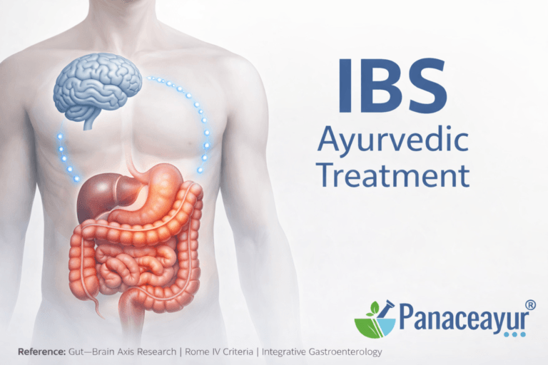 Clinical illustration showing the gut–brain axis in irritable bowel syndrome (IBS), highlighting digestive system involvement and Ayurvedic treatment perspective