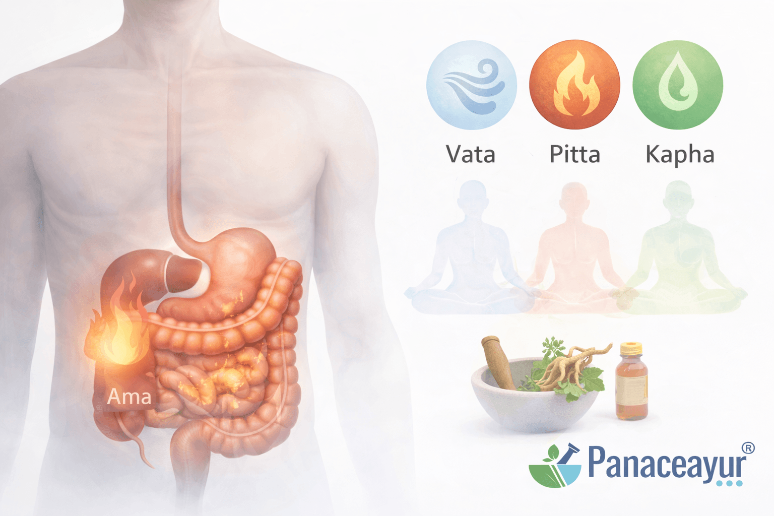 Clinical illustration showing digestive dysfunction in irritable bowel syndrome (ibs) explained through the ayurvedic grahani concept and dosha imbalance