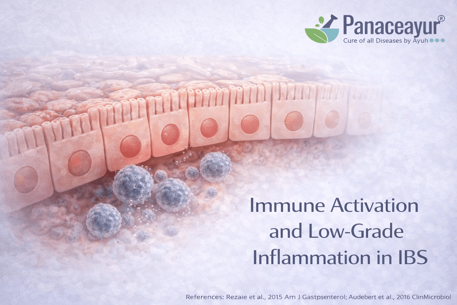 Immune Activation And Low-Grade Inflammation In Ibs Medical-style illustration showing low-grade immune activation in irritable bowel syndrome, with subtle immune cell presence near the intestinal lining without overt inflammation.