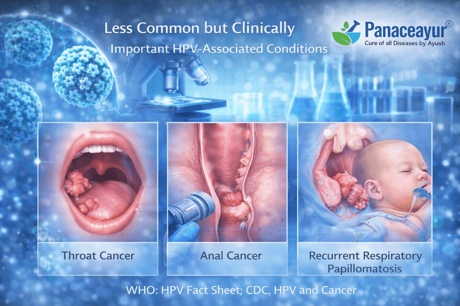 Microscopic clinical illustration showing less common but clinically important hpv-associated conditions with immune and tissue involvement