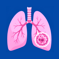 Lung Cancer : Herbal support for lung health.