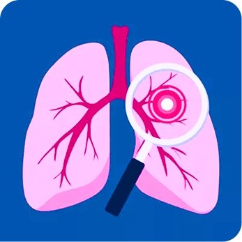 Lung cancer