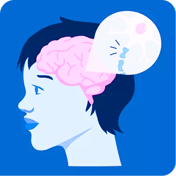 Multiple sclerosis