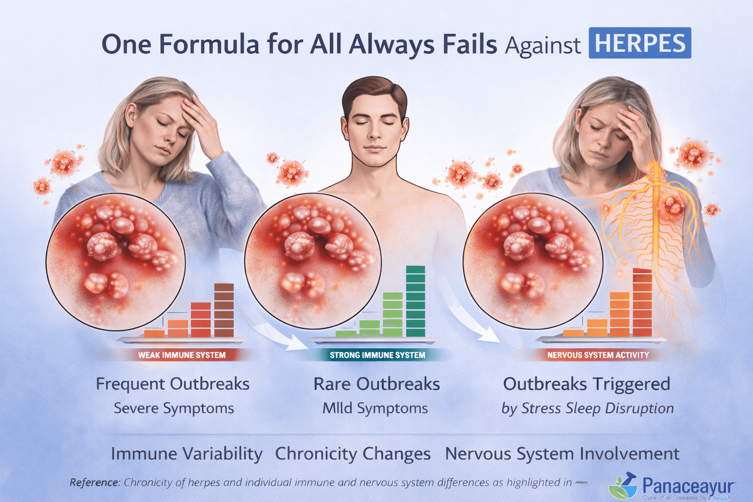 Why Herpes Medicines Fail-The Real Reason Outbreaks Keep Coming Back 2 One formula for all approach always fails