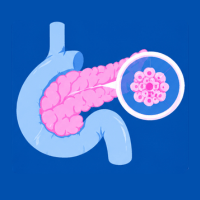 Pancreatic Cancer - Natural support for pancreatic health.