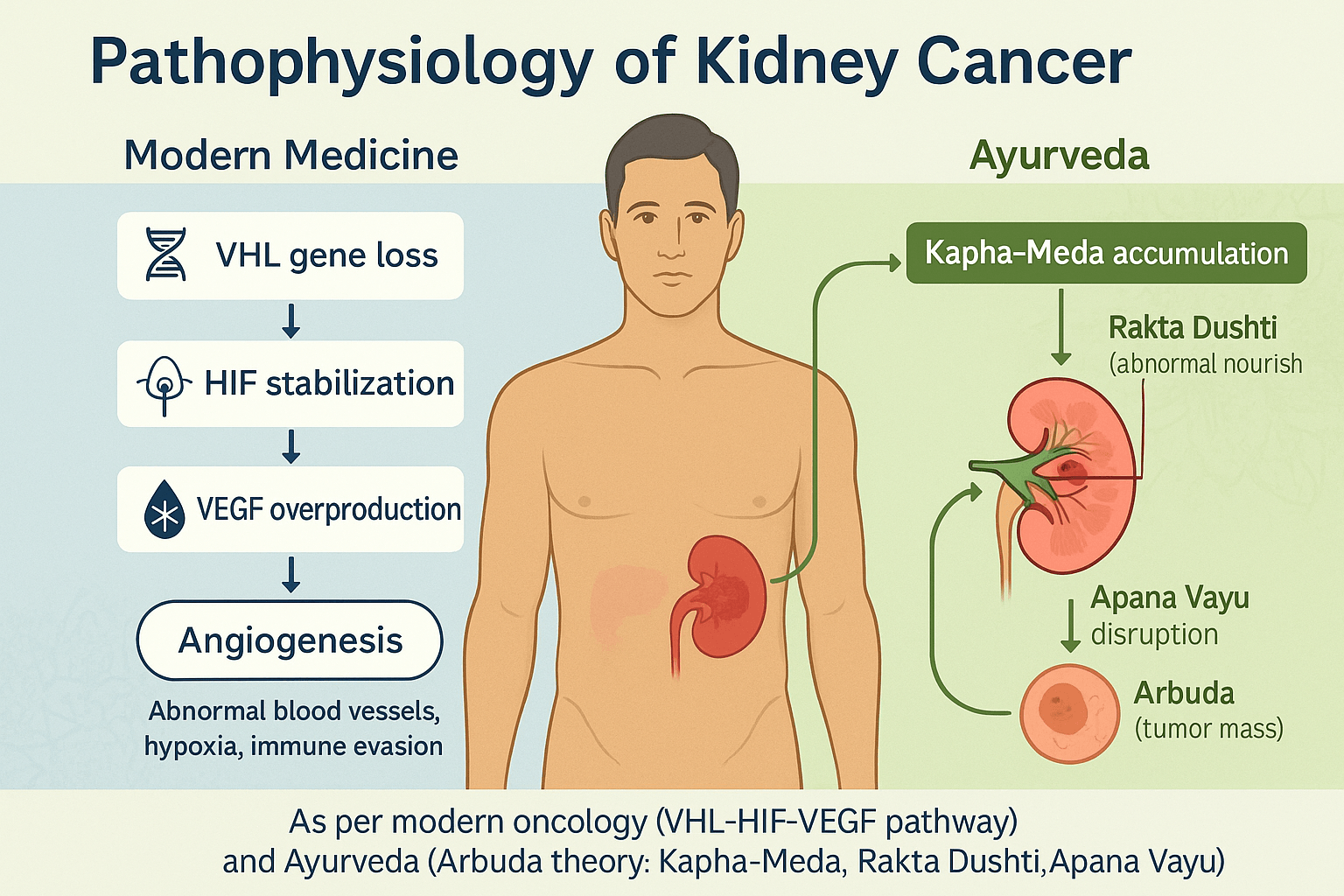 Kidney Cancer-Symptoms, Diagnosis, Treatment, And Ayurvedic Cure 4 Pathophysiology of kidney cancer