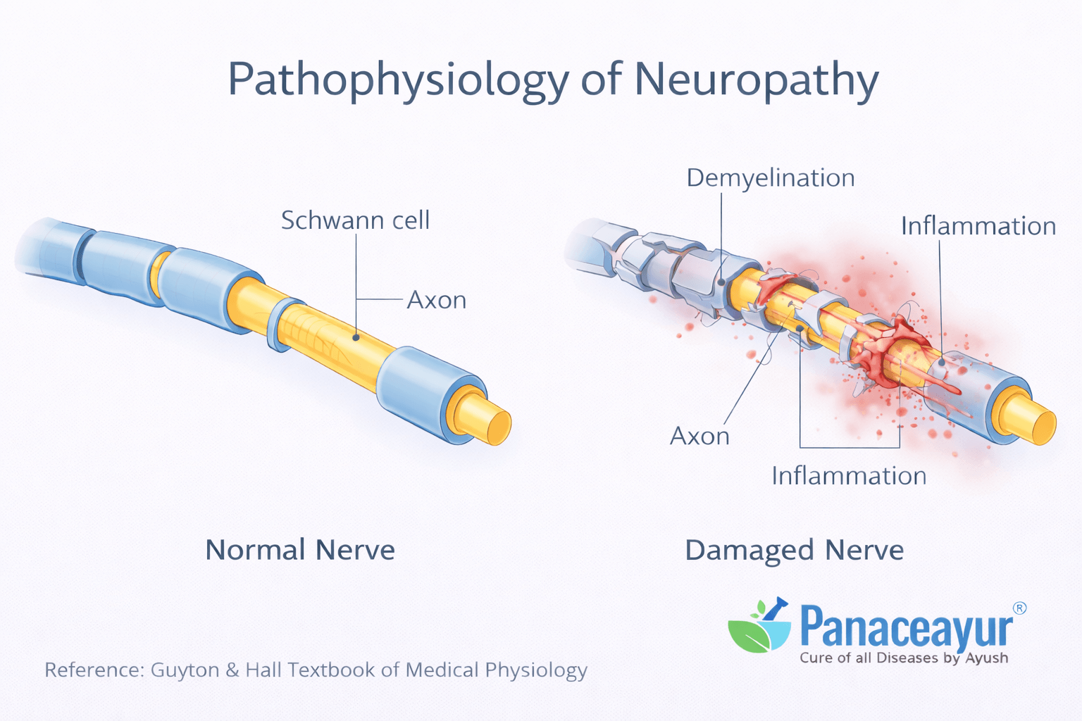 Pathphysiology