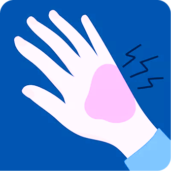 Psoriasis