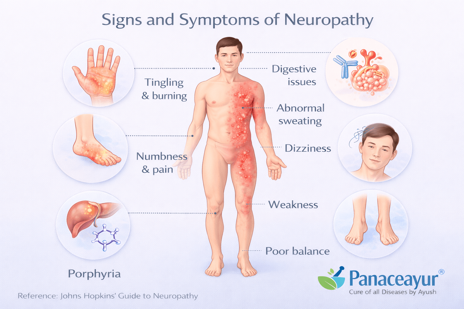 Signs and symptoms of neuropathy