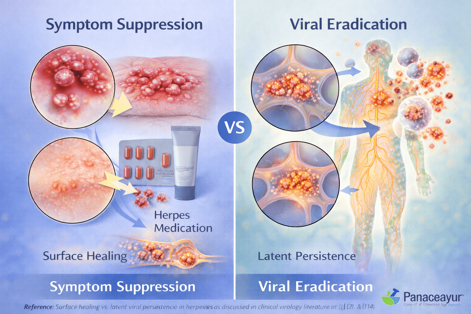 Symptom suppression vs viral eradication