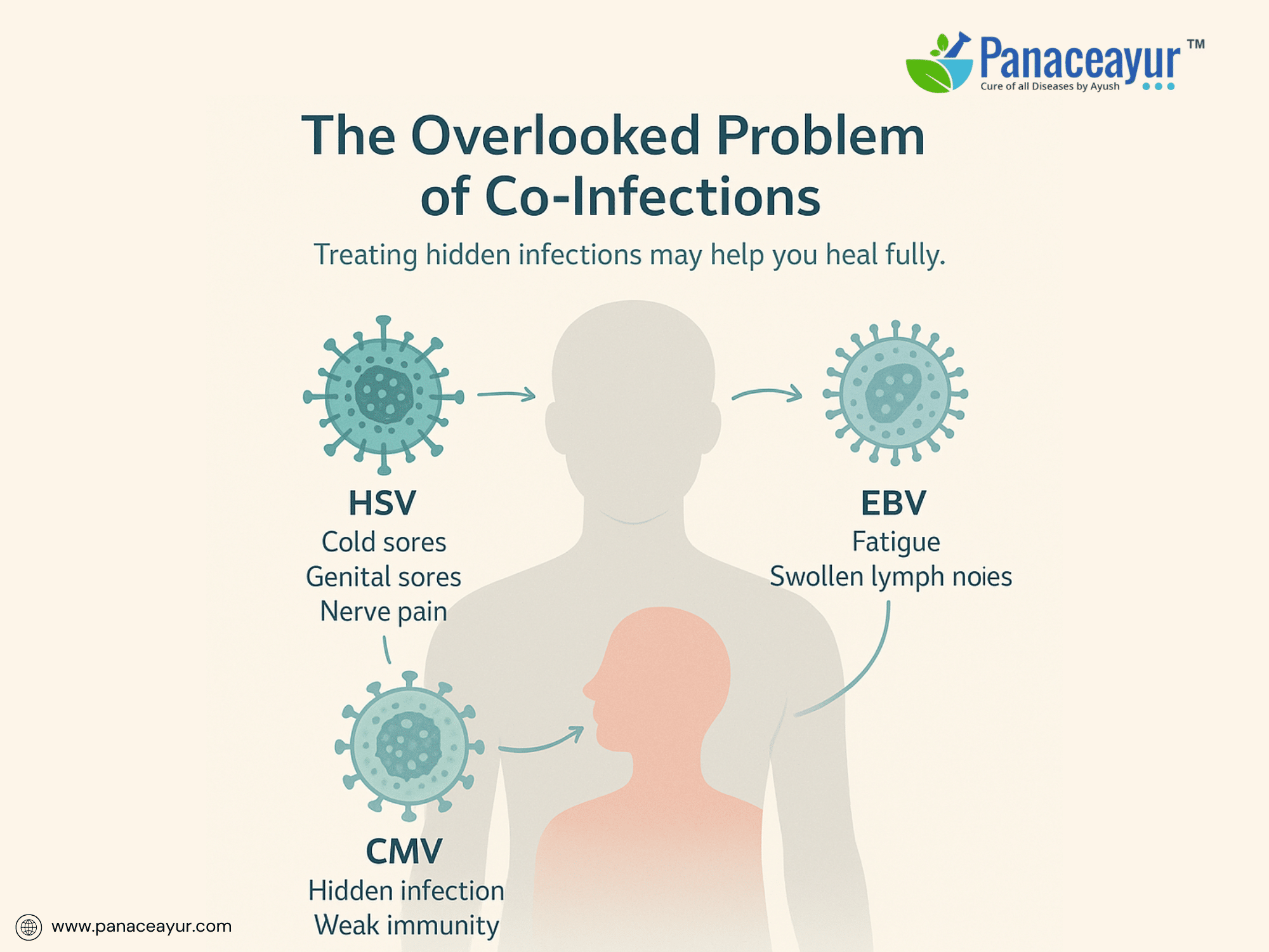Herpes Co-Infections- Hsv-1, Hsv-2, Cmv, Ebv And Ayurveda Cure 1 The overlooked problem of co-infections