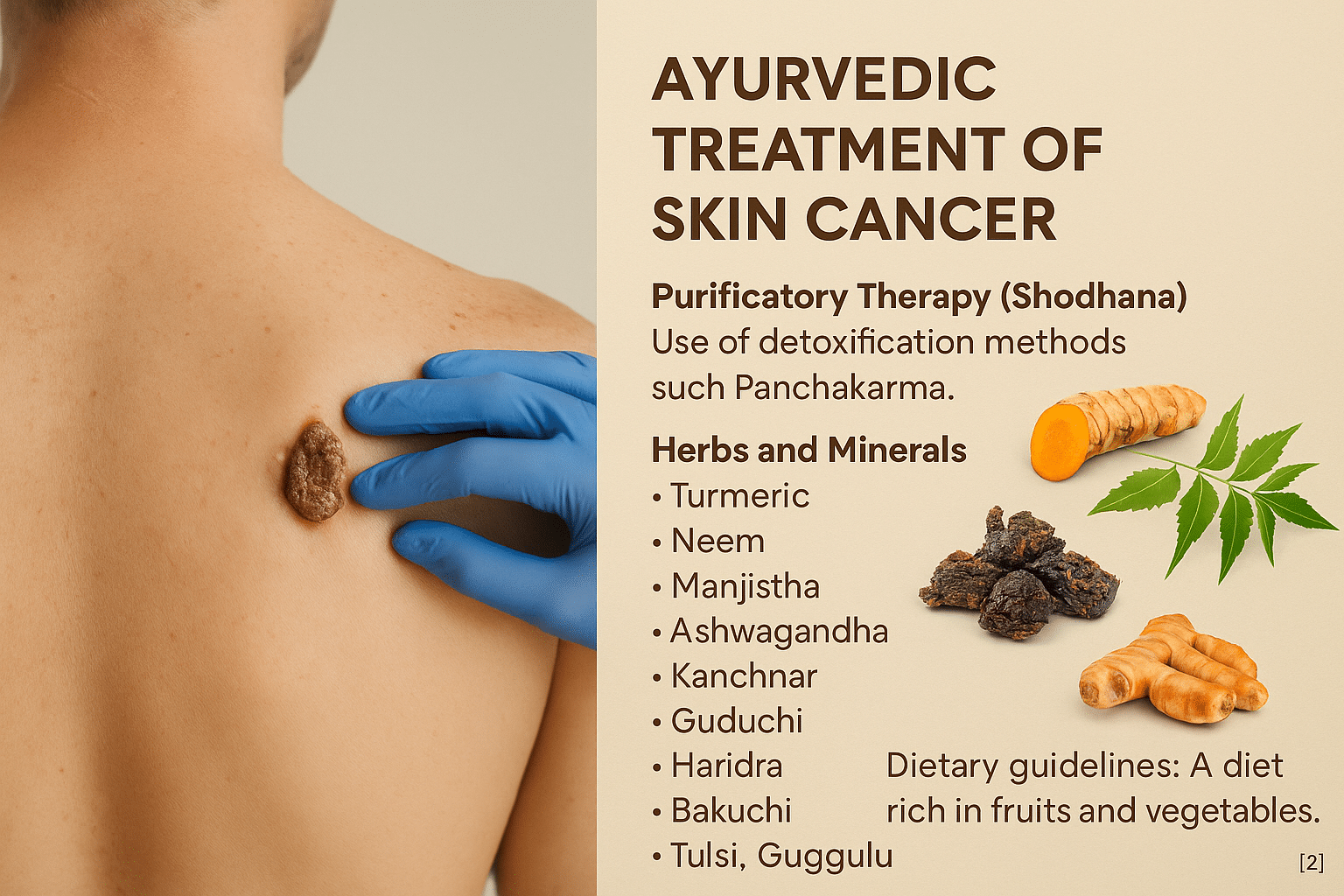 Skin Cancer: Integrative Diagnosis And Ayurvedic Cure 5 Treatment 1 1