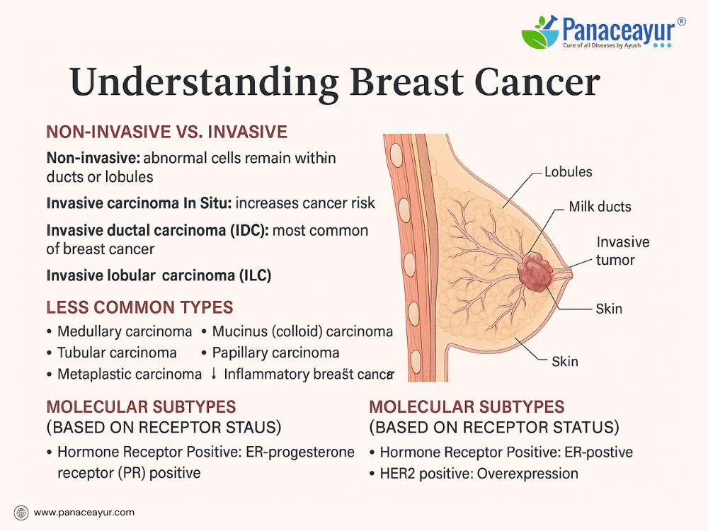 Curing Breast Cancer With Ayurveda 1 Types of breast cancer 1