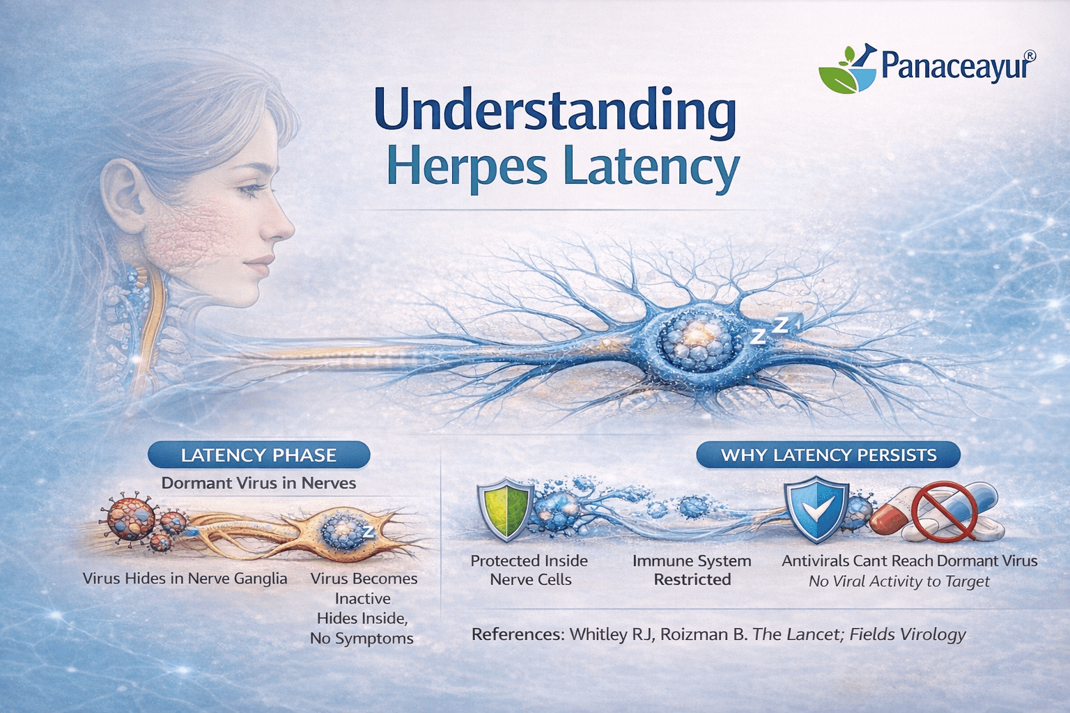 Understanding herpes latency illustrated with a clinical nerve pathway graphic showing dormant herpes virus inside sensory nerve cells