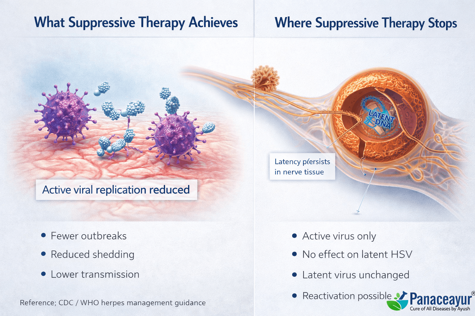 Clinical infographic showing how suppressive antiviral therapy reduces active herpes virus replication but does not affect latent virus in nerve tissue
