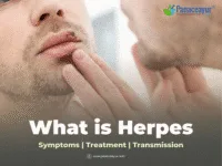 Book A Consultation 33 What is herpes