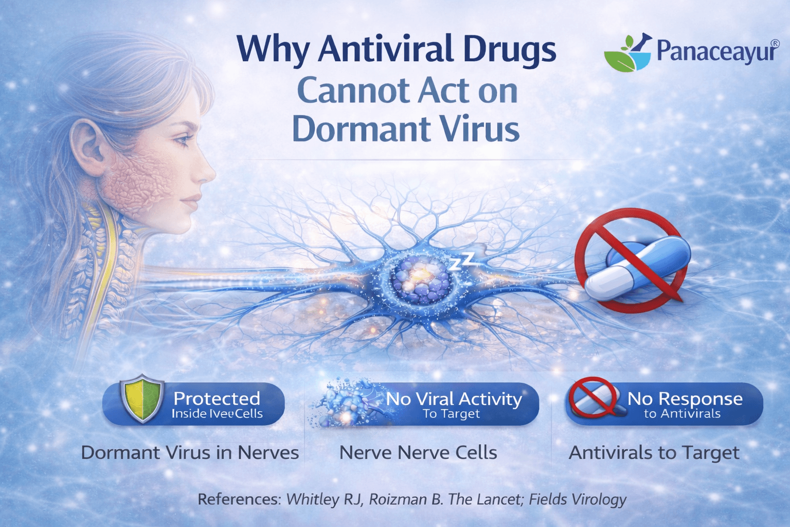 Clinical illustration showing dormant herpes virus inside nerve cells with antiviral drugs unable to act due to viral inactivity