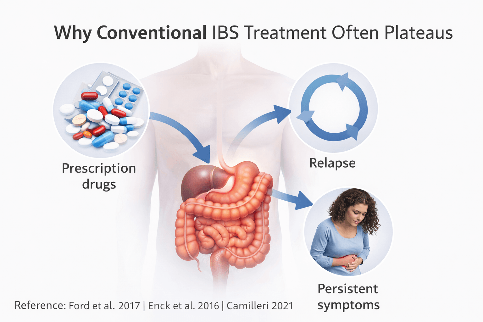 Minimal clinical illustration showing digestive system involvement and treatment plateau in irritable bowel syndrome