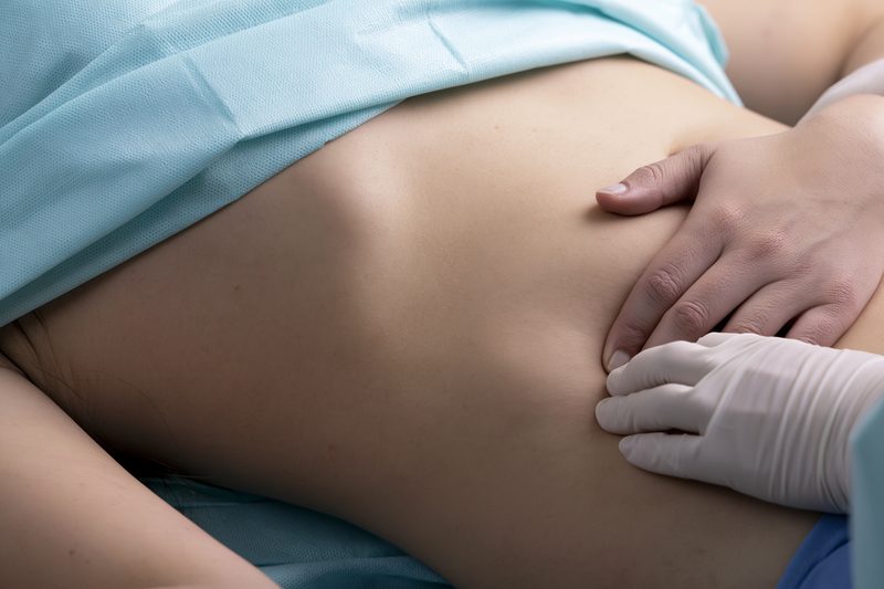 Desmoid Tumor Symptoms: Recognize Lumps, Pain And Abdominal Warning Signs 10 Abdominal wall desmoid clinical case presentation