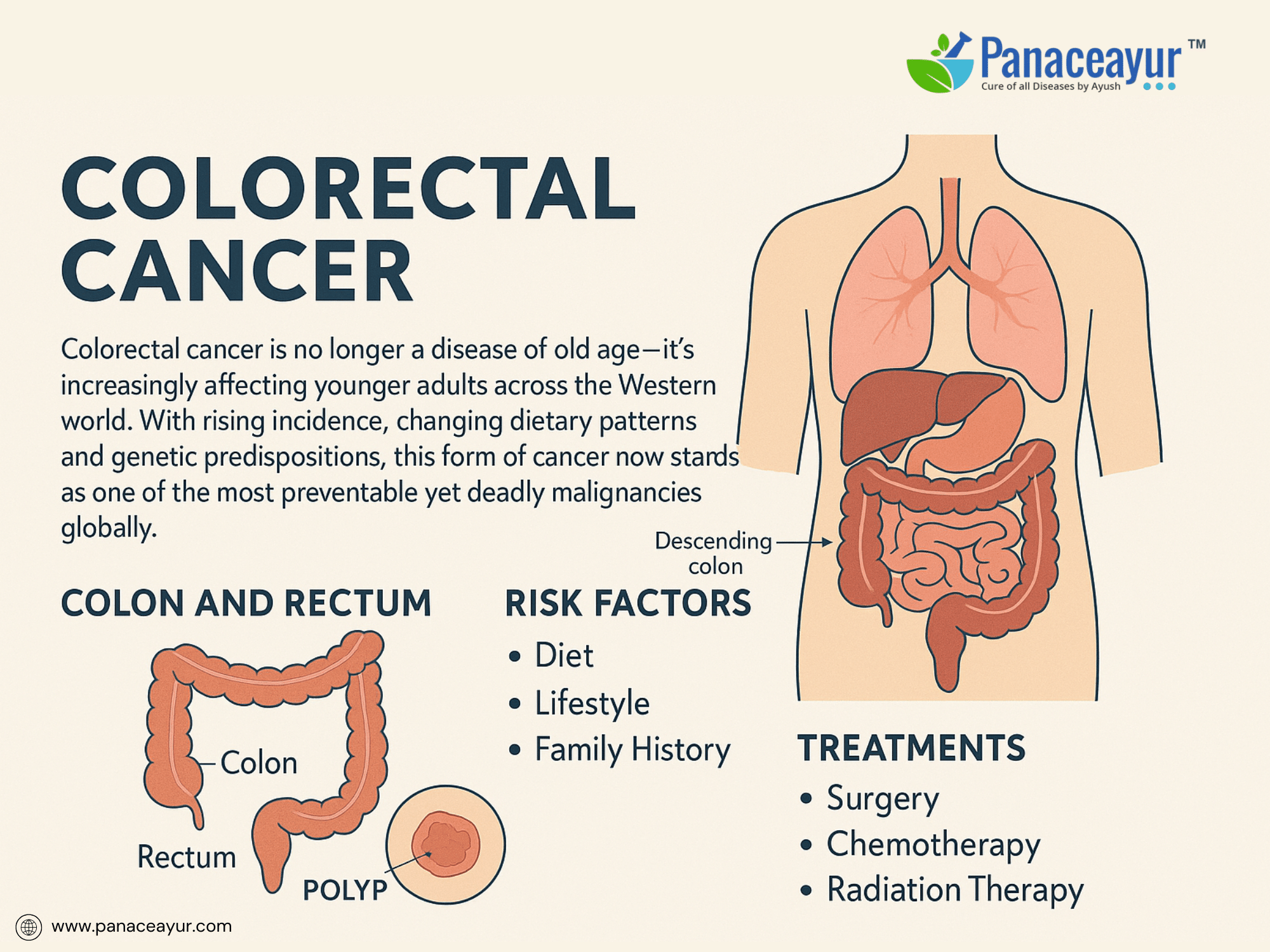 Colorectal Cancer Treatment—Ayurveda