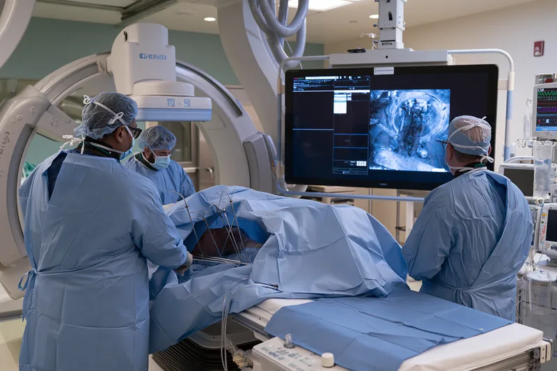 Desmoid Tumor Treatment Without Surgery: How To Monitor, Treat And Know When To Act 11 Ct guided cryoablation for desmoid tumor