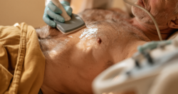 Abdominal ultrasound examination during desmoid tumor assessment