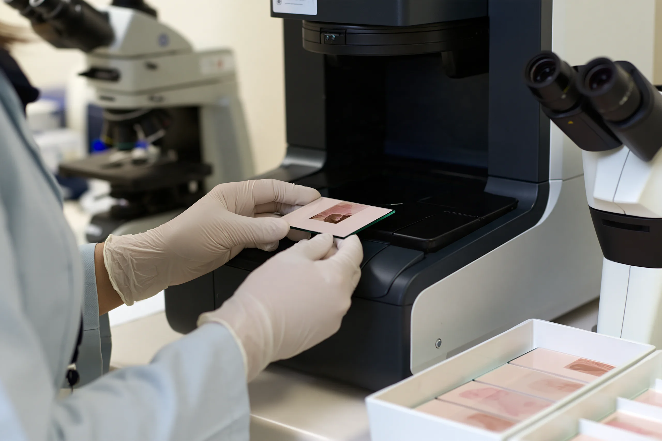 Metastatic Esophageal Cancer Treatment: Biomarker-Guided Care 1 Esophageal-cancer-biomarker-testing-laboratory. Webp