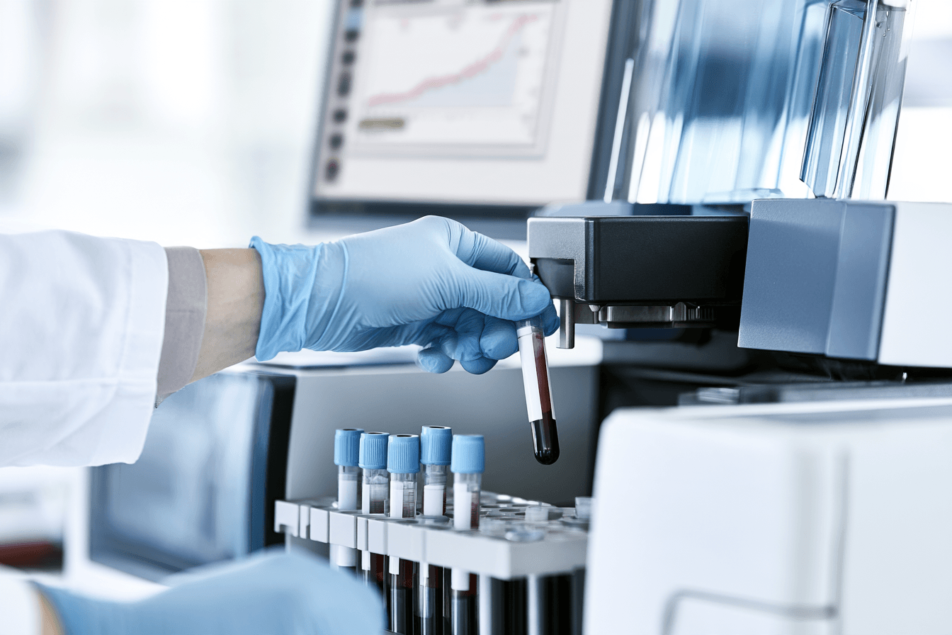 Iron Overload In Thalassemia: How Ferritin, Liver Mri, Cardiac Mri And Chelation Protect Your Organs 3 Ferritin test iron overload thalassemia