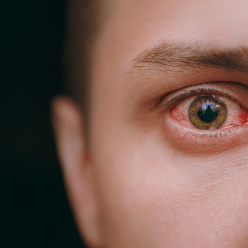 Book A Consultation 4 Herpes consultation 2 panaceayur