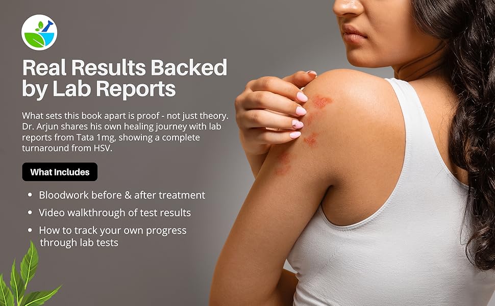 Herpes Cure: A Research-Backed Guide To Healing Through Herbal Medicine 10 Herpes cure book banner 2