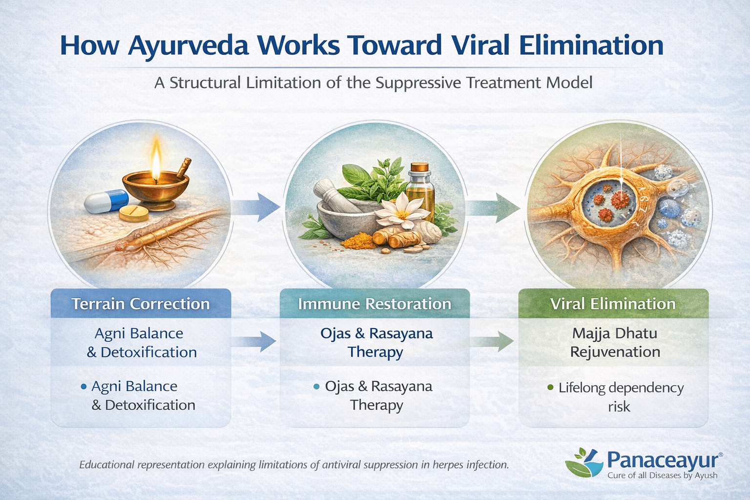 Ayurvedic Cure For Herpes- Root Cause Viral Elimination Explained 14 How ayurveda 1 1