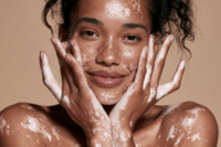 Woman with visible vitiligo patches on face, hands, arms and shoulders showing active skin depigmentation.
