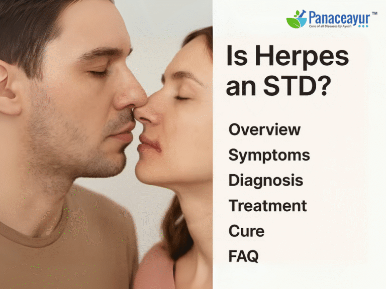 is Herpes an std by panaceayur