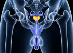 Medical illustration of male prostate anatomy showing the prostate gland and urinary system for prostate cancer PSA level assessment