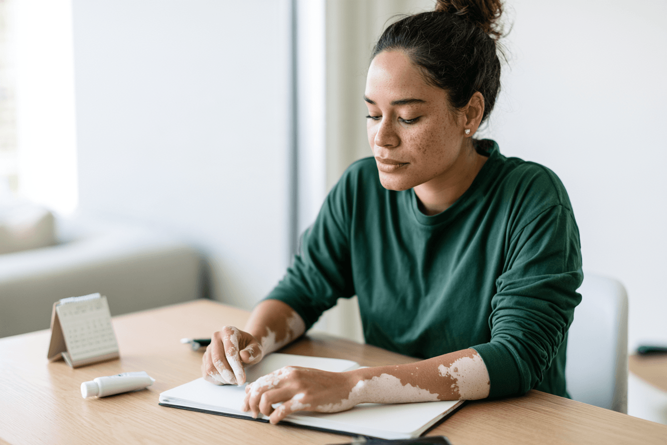 Can Vitiligo Be Cured Permanently? Treatment Results And Ayurveda 4 Woman with vitiligo organizing a treatment notebook and calendar at home.