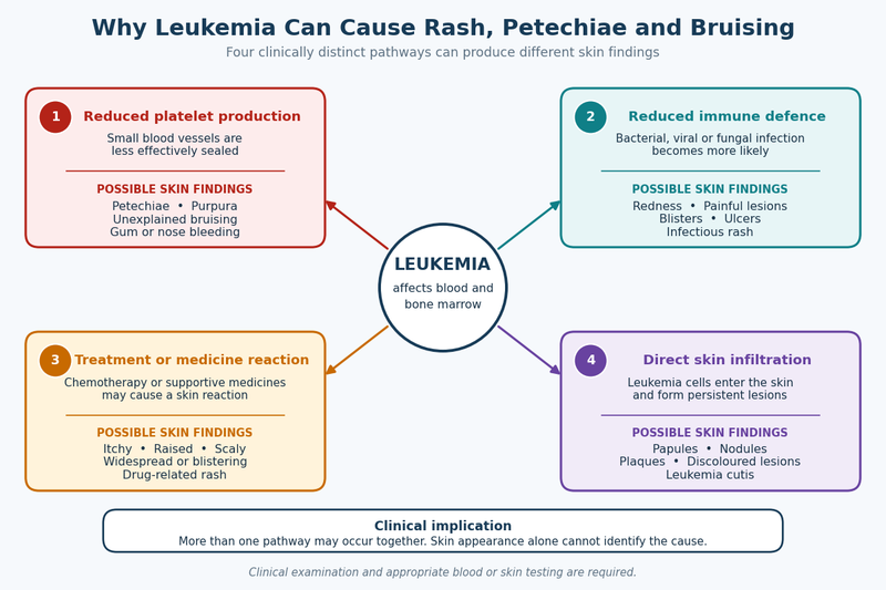 Leukemia Rash And Bruising: What Skin Changes Can Mean 2 Why leukemia causes rash bruising medical graph 1200x800 final